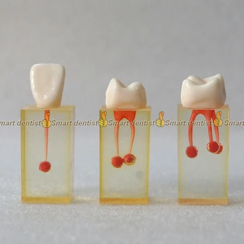 1 set x Smolo Zobni kanal Endodontic Študent Študijske Prakse Delovanja Modela z Barvnim Root Canal