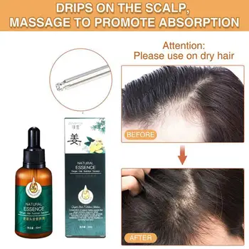 30 ml 7X Hitro Rast Las Zdravljenja Anti Hair Loss Hitro Rast Las Serum Ingver Eterično Olje Za Napredno Redčenje Las