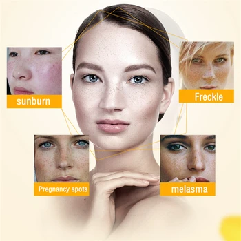 Dimollaure obraz, kreme za beljenje odstranitev Freckle pjega starostnih peg melasma opekline acne scar removal cream DIMORE krema za obraz