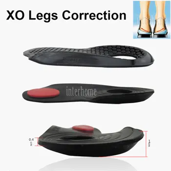 Upscale X/O type noge Ortopedije Silikonski Ortopedski Vložki Ravno Stopala Popravek Lepoto Noge, Oblikovanje Telesa Noge, Nego Čevlji Pad